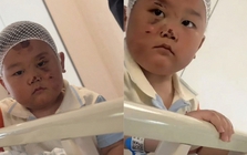 Bé trai 3 tuổi túc trực chăm mẹ sau tai nạn nghiêm trọng: Mặc dù chính bé bị nhiều vết thương đau đớn nhưng vẫn theo sát mẹ không rời