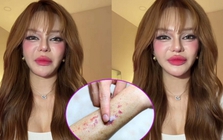 Video lúc nửa đêm của TikToker 11 triệu người theo dõi khiến nhiều người giật mình: Ung thư máu có đến từ thói quen thức khuya, uống trà sữa?