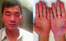 Người đàn ông không bia rượu nhưng ngày nào cũng bị kiểm tra nồng độ cồn, biết sự thật phía sau ai cũng xót xa