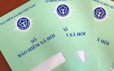 Ký hợp đồng dịch vụ có phải đóng các loại bảo hiểm?