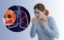 Không hút thuốc vẫn bị ung thư phổi: 2 yếu tố hầu như ai cũng gặp mỗi ngày