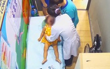 Khẩn cấp cứu nguy cháu bé 12 tháng tuổi tím tái vì sặc sữa