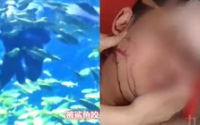 Du khách đi lặn bị cá mập cắn vào đầu, nhân viên vẫn hỏi “có muốn tiếp tục không?”