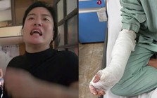 Bị khách "bùng" tiền 30 bánh chưng, chém nhập viện: Tình trạng sức khỏe của chủ quán