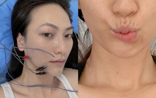 Nữ chính phim trăm tỷ của Trấn Thành: Từng đi bán xôi lề đường, bị biến chứng sau ca mổ tuyến giáp