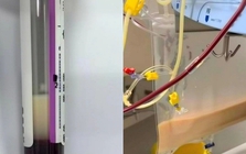 Người phụ nữ ngoài 30 tuổi máu trắng như sữa sau khi uống 4 cốc nước "vạn người mê" trong 1 ngày