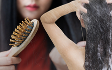 Gội đầu kiểu này cực hại da đầu lại dễ gây hói: Đáng tiếc nhiều người Việt vẫn mắc, thay đổi ngay hôm nay để cứu lấy mái tóc