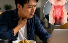 Bác sĩ cảnh báo: 1 THÓI QUEN sau bữa ăn nhiều người Việt làm mỗi ngày có thể ảnh hưởng đến tuyến giáp, nên thay đổi trước tuổi 40