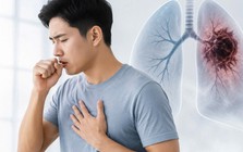 Không phải cơn ho: Bác sĩ cho biết ngón tay đôi khi là nơi đầu tiên cảnh báo ung thư phổi