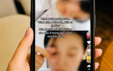 Nữ sinh dọa 'lấy trật ven 3 lần' bệnh nhân, Đại học Y Hà Nội lên tiếng