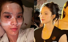 Bà chủ resort miền Tây từng khiến Tiểu Vy "out nét" khi đứng cạnh nay gặp kiếp nạn nhan sắc