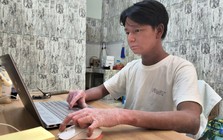 Cậu bé "người rắn" từng bị bạn bè xa lánh, 12 tuổi mới được vào lớp 1, giờ đã thành tân sinh viên