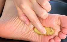 Trước khi đi ngủ, nhiều người có thói quen đắp gừng, hành vào lòng bàn chân để ngủ ngon: Chuyên gia nói 1 câu ai cũng bất ngờ