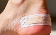 Bé gái sốt 39,3 độ C suốt 2 ngày, nhập viện mới phát hiện thủ phạm là 1 miếng băng cá nhân