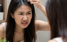 Lời khuyên cho tất cả những người cứ thấy tóc bạc là nhổ