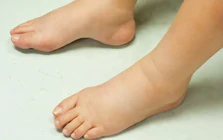 9 dấu hiệu thận đang ‘kêu cứu’