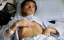 Người đàn ông 53 tuổi nhận "án tử" ung thư gan, bác sĩ tức giận: Đừng làm việc này quá 3 lần 1 tháng!