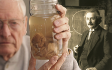 Chuyện gì đã xảy ra với bộ não thiên tài của Albert Einstein sau khi ông qua đời?