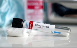 Thêm 3 bệnh nhân COVID-19 dương tính trở lại sau khi công bố khỏi bệnh