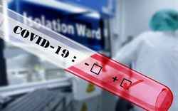 Hà Nội: Xét nghiệm SARS-CoV-2 các trường hợp bị tạm giam, tạm giữ
