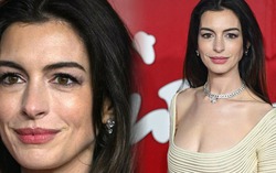 Bức ảnh cận cảnh không chỉnh sửa của Anne Hathaway ở tuổi 41 gây sốt, liệu còn là 