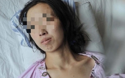 Đi khám vì khó tiêu, người phụ nữ phát hiện ung thư gan: BS hoảng hốt: "Ai lại ăn sáng kiểu này suốt 20 năm?"