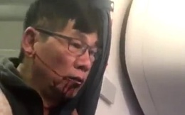 Cổ phiếu United Airlines "hồi sinh” sau bê bối đẩy khách gốc Việt khỏi máy bay