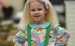 Bé gái có "mái tóc bất trị" giống hệt nhà bác học Einstein, trên thế giới chỉ 100 người như vậy