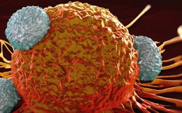Chuyên gia hàng đầu VN nói về hiệu quả của thuốc miễn dịch trị ung thư giá 62 triệu/lọ