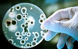 Xuất hiện bệnh nhân kháng tất cả các loại kháng sinh, bác sĩ cảnh báo "cuộc chiến" của siêu vi khuẩn với loài người