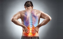 5 nguyên nhân khiến lưng đau, nhức mỏi nhiều người mắc phải nhưng không nhận ra