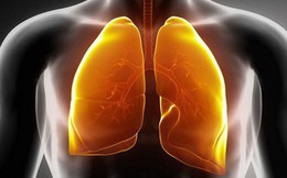 Hút thuốc khiến phổi bị "nhuộm" đen và sinh bệnh: Cách thanh lọc phổi bạn nên áp dụng sớm