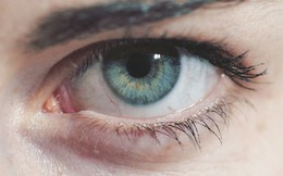 Đôi mắt đang bị "tấn công" bởi thiết bị công nghệ: 3 cách quan trọng để không làm hỏng mắt