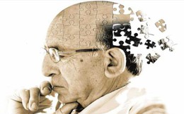 8 biện pháp được nghiên cứu bởi khoa học có thể ngăn ngừa bệnh Alzheimer và giúp bạn vượt qua chứng mất trí nhớ