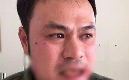 Tạm giữ hình sự người phụ nữ đánh gãy răng nhân viên an ninh Cảng hàng không Nội Bài