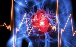 9 dấu hiệu cảnh báo bạn có thể bị suy tim tăng nặng: Có 1 điểm trùng là nên đi khám