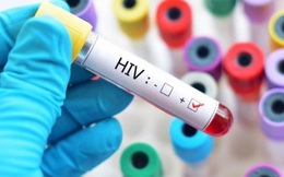 Chủng virus HIV mới phát hiện sau 20 năm có đáng sợ hay không?