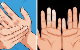 Cẩn thận với căn bệnh thường gặp phải khi trời lạnh khiến ngón tay và ngón chân của bạn đổi màu trắng xanh