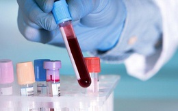 Nghiên cứu mới của các bác sĩ Vũ Hán: Người mang nhóm máu A có thể nhạy cảm hơn với virus Covid-19
