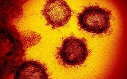 Lý do vì sao virus gây bệnh Covid-19 khó tiêu diệt đến thế: Kẻ nằm giữa "hóa học và sinh học", "sống và không sống"