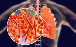 4 cách đơn giản giúp bạn nuôi dưỡng phổi khỏe mạnh, tránh xa bệnh tật trong mùa đông