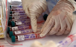 Chuyên gia cảnh báo: Test nhanh ÂM TÍNH không có nghĩa bạn hoàn toàn KHÔNG nhiễm SARS-COV-2