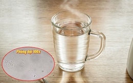 SỰ THẬT rùng mình về nước sôi để nguội khi soi dưới kính hiển vi và 3 loại nước lọc không nên uống để tránh nhiễm độc, mắc ung thư