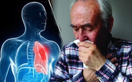 Người đàn ông 47 tuổi được chẩn đoán bị ung thư phổi: Bác sĩ cảnh báo nếu cơ thể xuất hiện "1 dày, 2 đen, 3 đau" này thì phải đi khám ngay kẻo phổi nát, cái chết gần kề