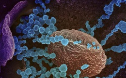 Sóng siêu âm có thể tiêu diệt virus SARS-CoV-2