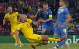 Cẳng chân của cầu thủ Ukraine bị đối thủ Thuỵ Điển đạp thành hình gấp khúc