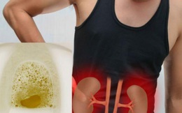 Nước tiểu vào buổi sáng tiết lộ thận tốt có hay không: Hãy đi kiểm tra thận ngay nếu nước tiểu của bạn có 3 đặc điểm bất thường này