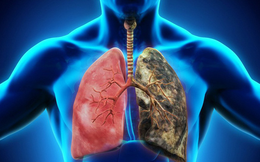 4 thói quen "khắc tinh" với bệnh tật đường hô hấp,làm đủ mỗi ngày thì ung thư phổi không dám đến gần
