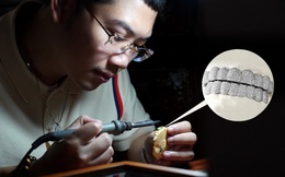 Chàng trai tạo trang sức kim cương cho răng, 400 triệu VNĐ/bộ: Khách hàng toàn người nổi tiếng