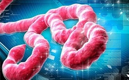 Miễn phí điều trị nếu mắc bệnh Ebola tại Việt Nam